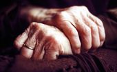 Psoriatická artritida se projevuje různě. Od bolesti prstu po deformity