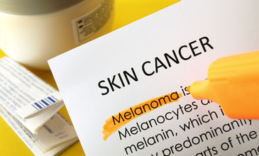 Nové možnosti biologické léčby pro pacienty s rakovinou kůže